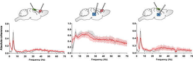 Techniques - Functional Neuroimaging - IIT